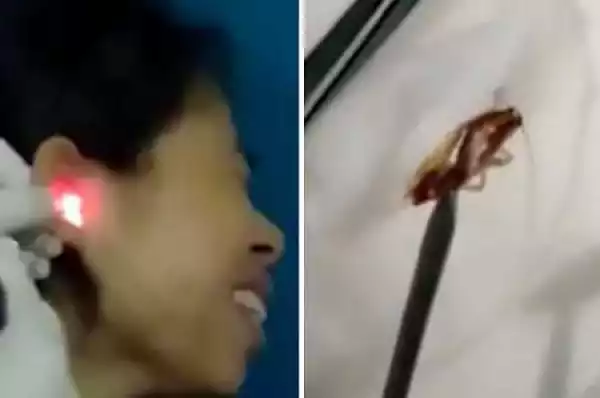 Shocking Moment a Live Cockroach Was Pulled Out from a Woman’s Ear in Bizarre Video